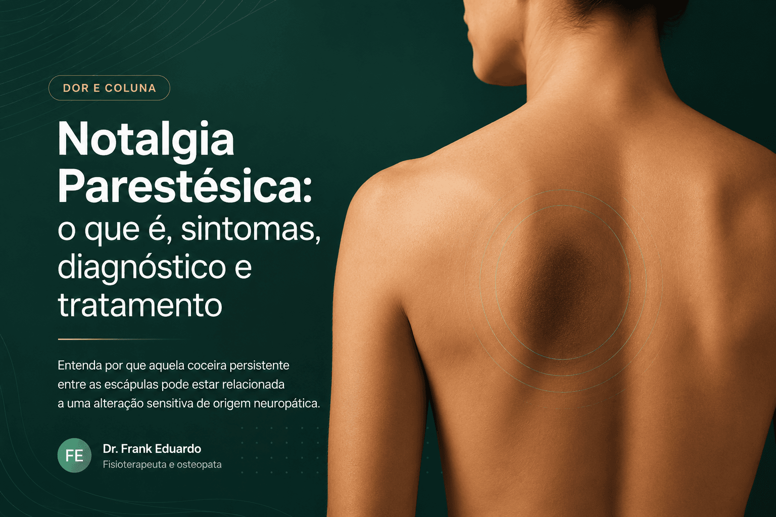 Notalgia parestésica com destaque para a região entre a coluna e a escápula